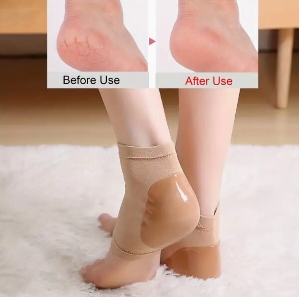 A pair of moisturizing heel straps for women and men - Image 2